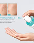 Тонер за лице ANUA BHA 2% Gentle Exfoliating Toner, 150 млКорейска Козметика | LovelyMe