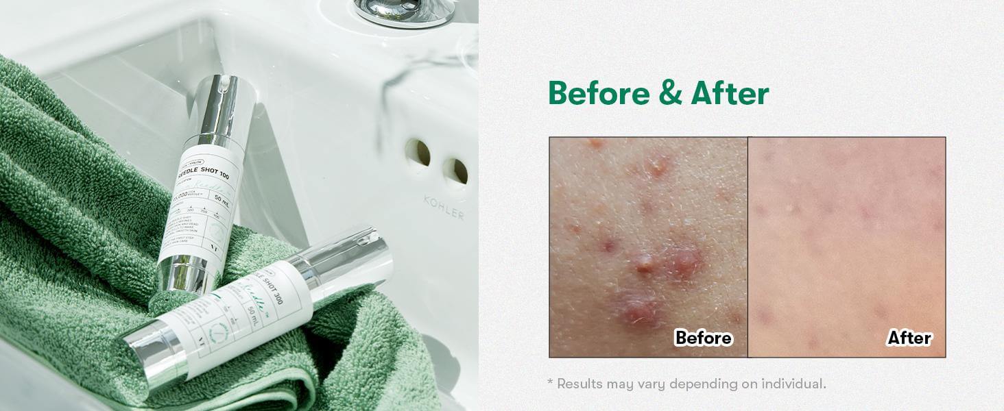 Ампула за лице VT COSMETICS VT Reedle shot 100, 50 mlКорейска Козметика | LovelyMe