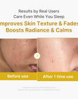 MediCube Kojic Acid Turmeric Night Wrapping Mask- Нощна маска за лице  75ml