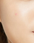 Пачове за Пъпки Cosrx Acne Pimple Master Patch 24 бр.